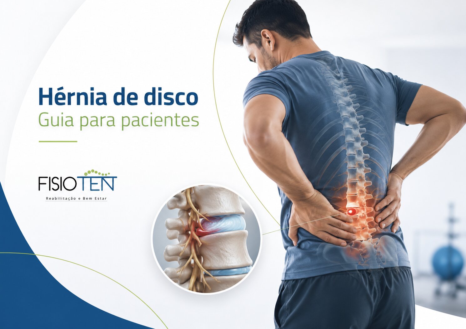 Imagem do artigo Hérnia de disco: guia completo para pacientes sobre sintomas, diagnóstico e tratamento