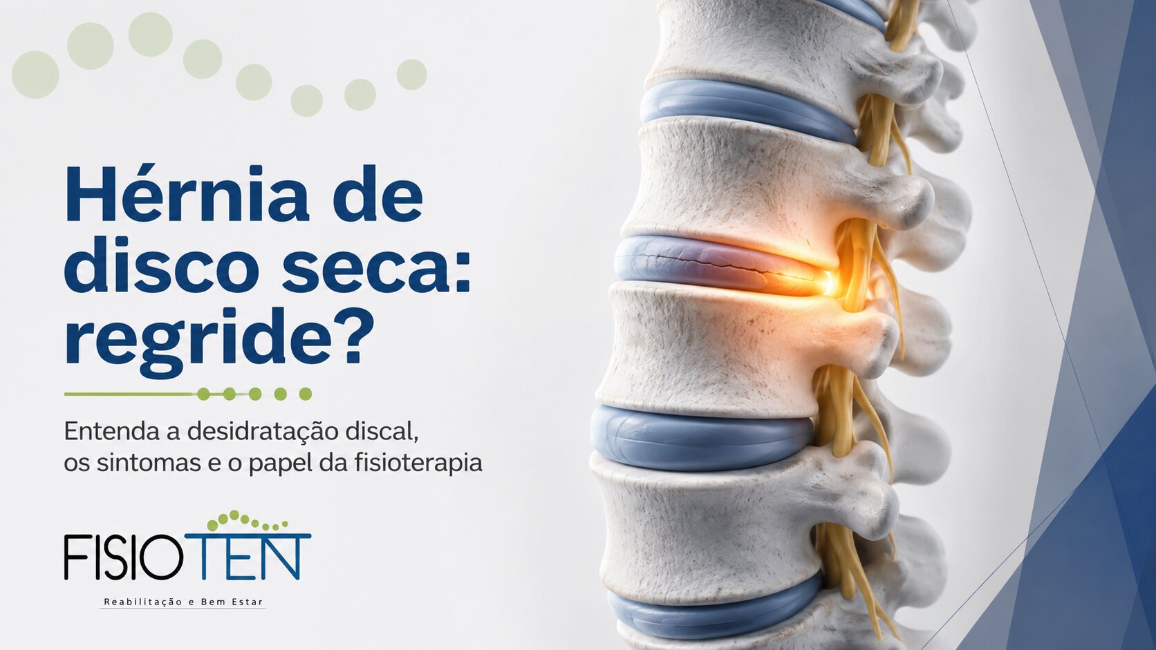Imagem do artigo Hérnia de disco seca regride? Entenda a desidratação discal e a reabsorção da hérnia